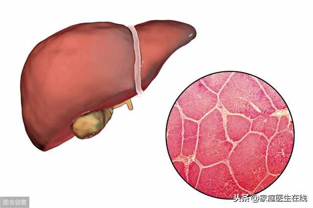 肝囊肿是怎么形成的？一般有这几种情况