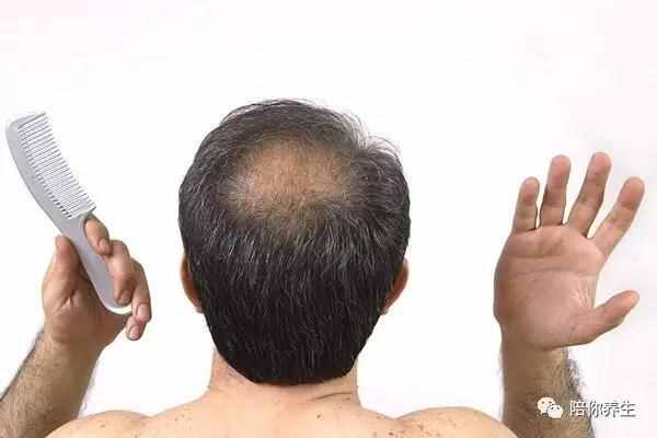 为什么男人更容易发生秃顶现象 可能是因为这些原因