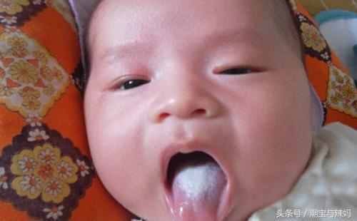 宝妈们你们知道宝宝舌苔发白的真正原因吗