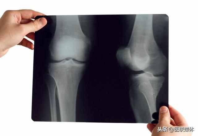 女人为什么容易膝盖痛？4个原因，很少男人能体会