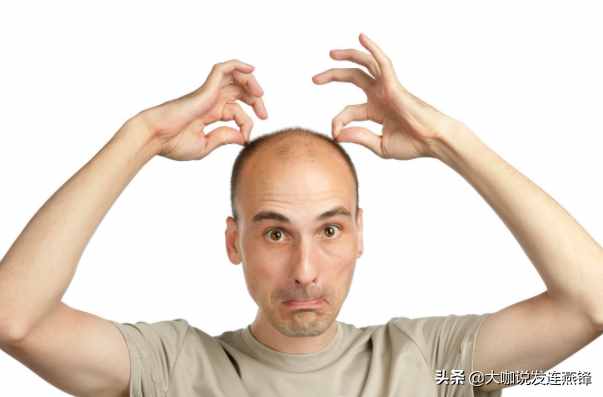 女性秃顶比男性秃顶少 除了雄性激素，这5个因素也是重点