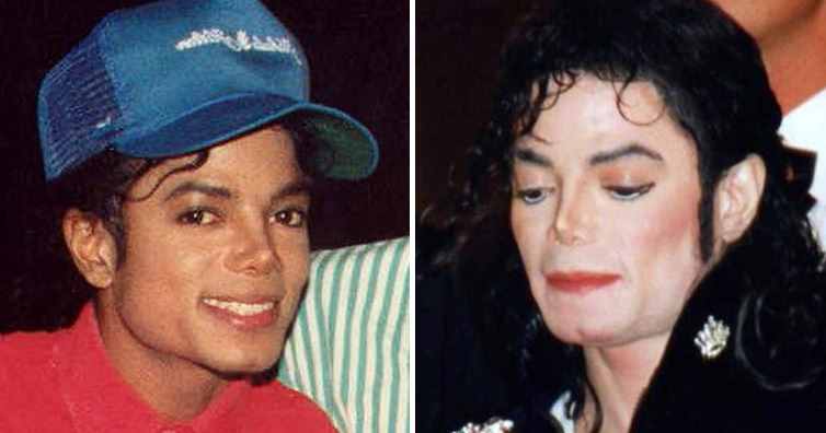 为什么迈克尔.杰克逊生前皮肤变得越来越白？