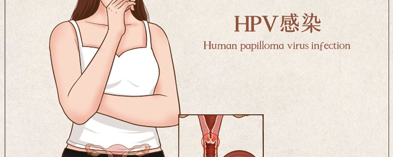 hpv是什么病 HPV的症状有哪些
