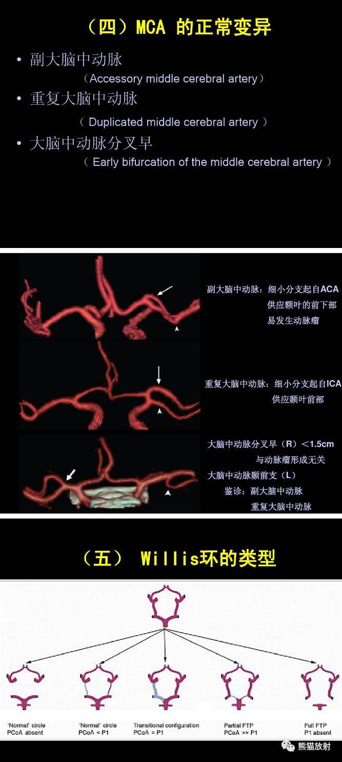 血管间隙名词解释__血管周围间隙分型