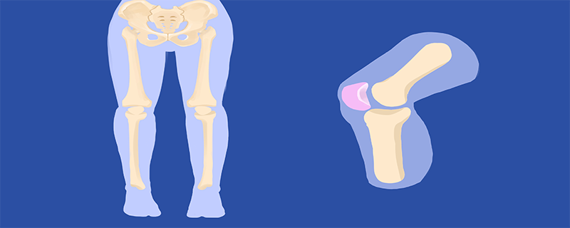 哪种动作会让膝盖承受的压力更大 膝盖承受的压力更大的是下蹲还是站立