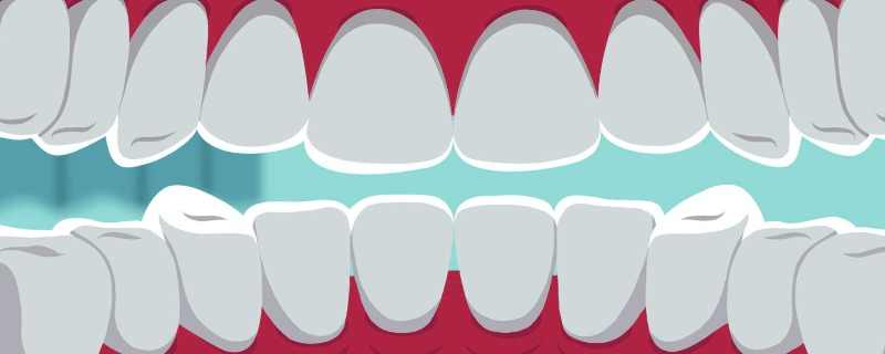牙齿越白越健康是真的吗 正常的人的牙都很白吗