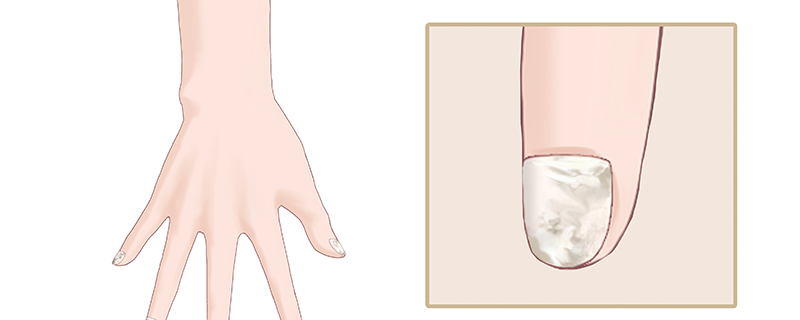 手指甲和脚趾甲哪个长得更快 手指甲为什么比脚趾甲长得更快